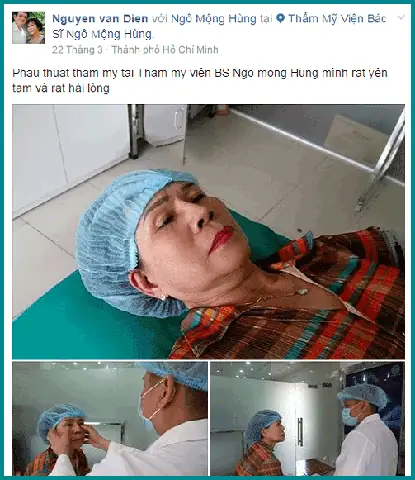 Tướng Người Có Hốc Mắt Sâu Tướng Người Có Hốc Mắt Sâu