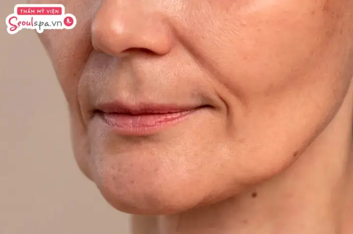 Tướng Người Có Khóe Miệng Cười
