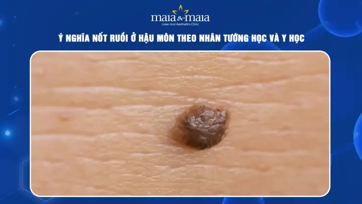 Tướng Người Có Lông Ở Hậu Môn
