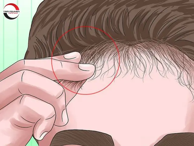 Tướng Người Có Nhiều Tóc Con