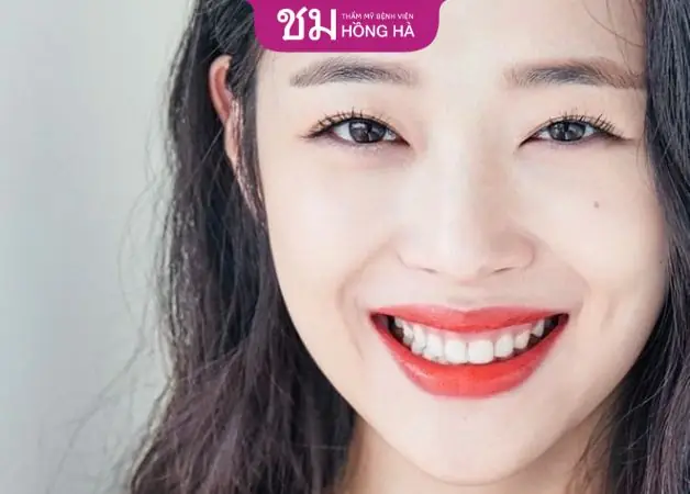 Tướng Người Cười Híp Mắt