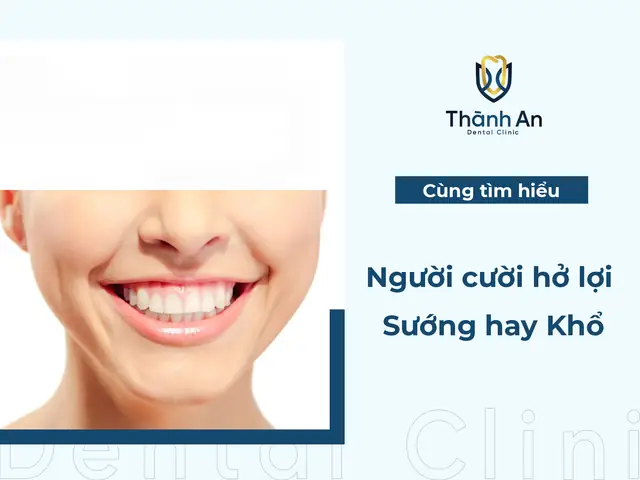 Tướng Người Cười Hở Lợi Nam