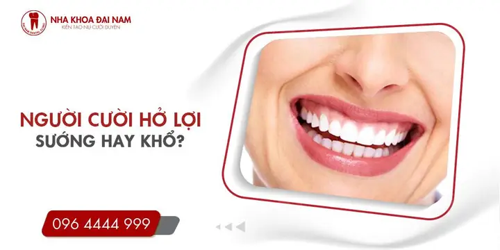 Tướng Người Cười Hở Lợi Nam
