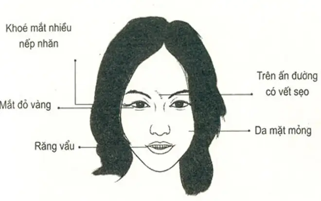 Tướng Người Da Mặt Mỏng