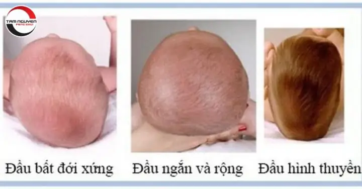 Tướng Người Đầu Nhỏ