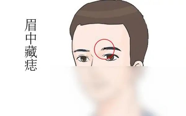 Tướng Người Kém Thông Minh