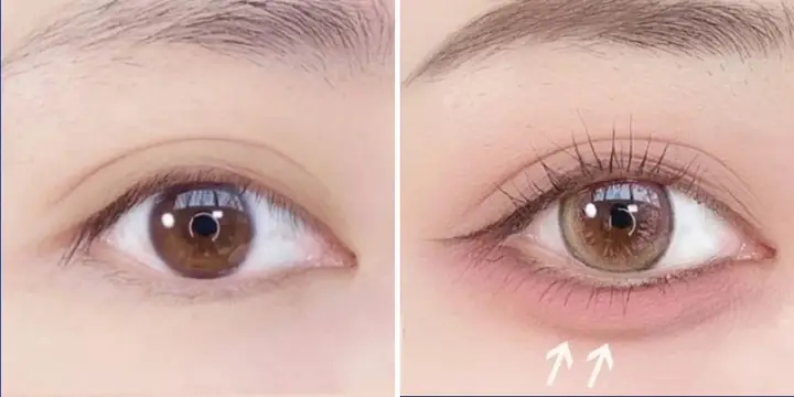 Tướng Người Không Có Bọng Mắt