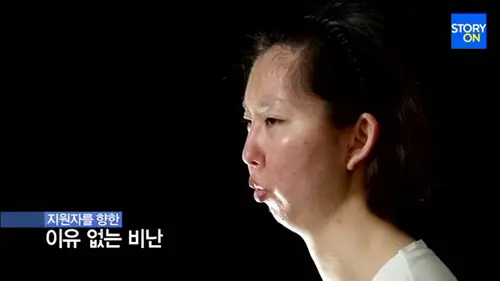 Tướng Người Không Có Cằm