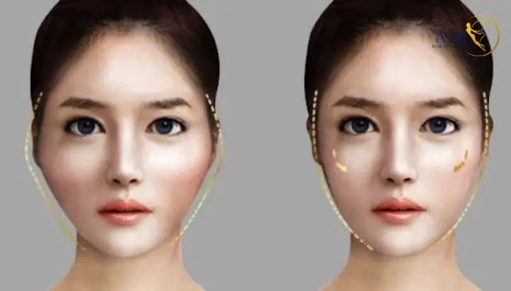 Tướng Người Lưỡng Quyền Cao Tướng Người Lưỡng Quyền Cao