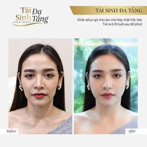 Tướng Người Má Hóp
