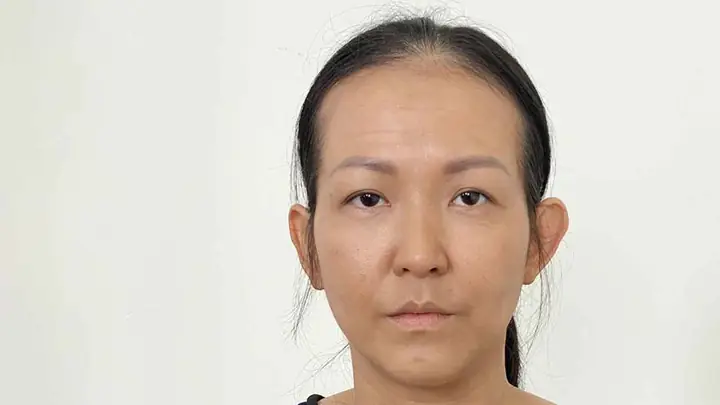 Tướng Người Má Hóp