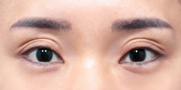 Tướng Người Mắt 3 Mí