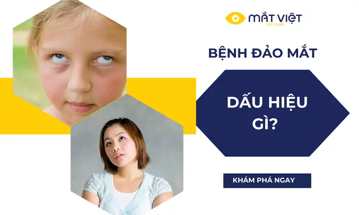 Tướng Người Mắt Đảo Liên Tục