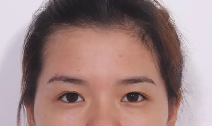 Tướng Người Mắt Mí Lót