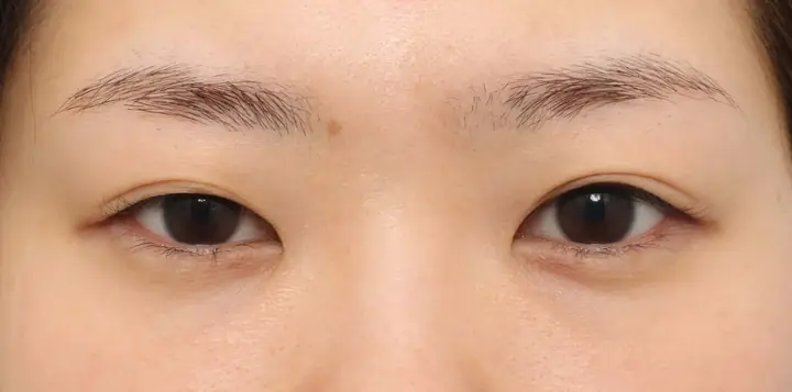 Tướng Người Mắt To Mắt Nhỏ Nam
