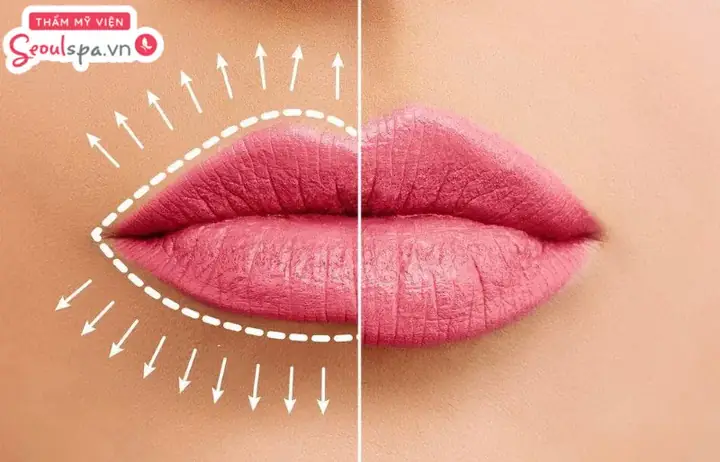 Tướng Người Mỏ Nhọn