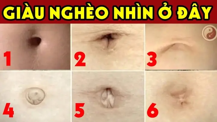 Tướng Người Rốn Sâu Tướng Người Rốn Sâu