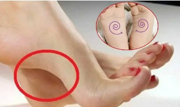 Tướng Phụ Nữ Có Bàn Chân To Tướng Phụ Nữ Có Bàn Chân To