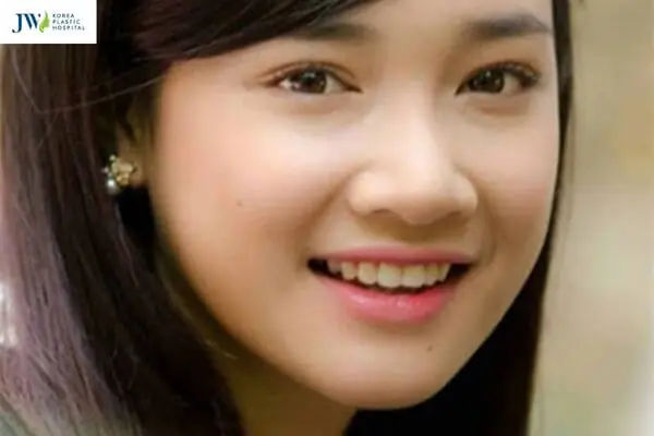 Tướng Phụ Nữ Đầu Mũi To
