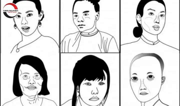 Tướng Phụ Nữ Gò Má Cao