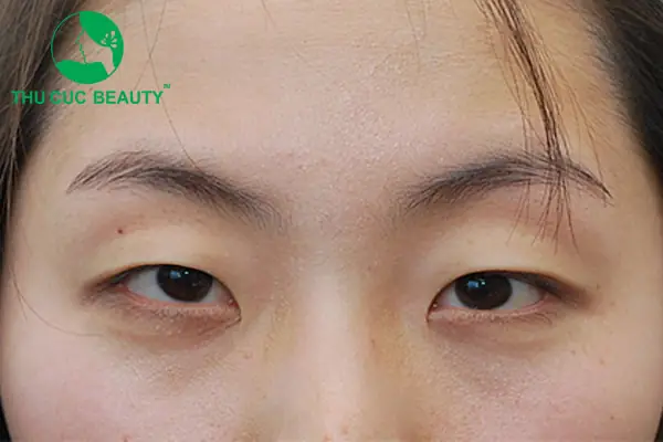Tướng Phụ Nữ Mắt Híp