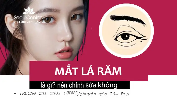 Tướng Phụ Nữ Mắt La Răm