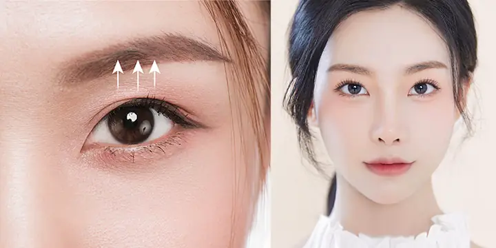 Tướng Phụ Nữ Mắt Sụp Mí