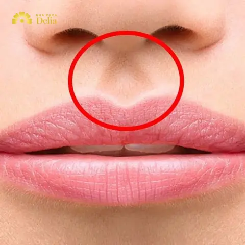 Tướng Phụ Nữ Nhân Trung Sâu Ngắn