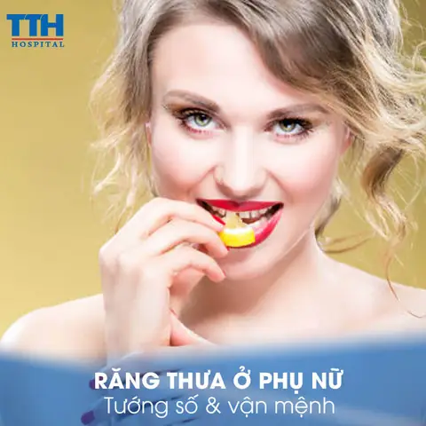 Tướng Phụ Nữ Răng Cửa To