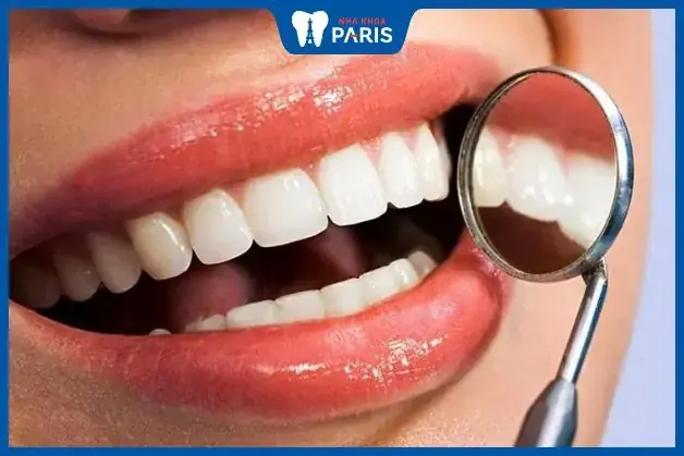 Tướng Phụ Nữ Răng Không Đều