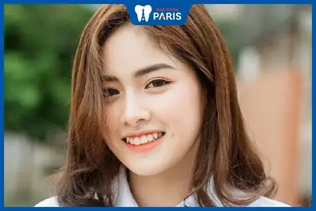 Tướng Phụ Nữ Răng Không Đều