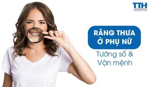 Tướng Phụ Nữ Răng Thưa