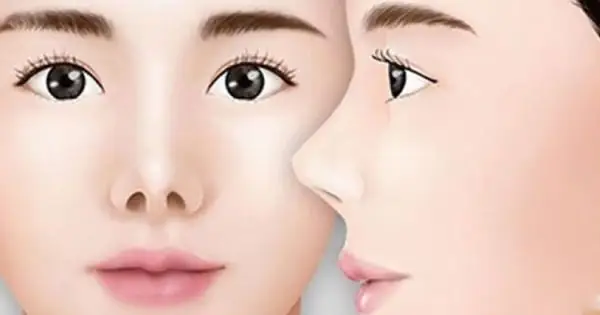 Tướng Phụ Nữ Yểu Mệnh Tướng Phụ Nữ Yểu Mệnh