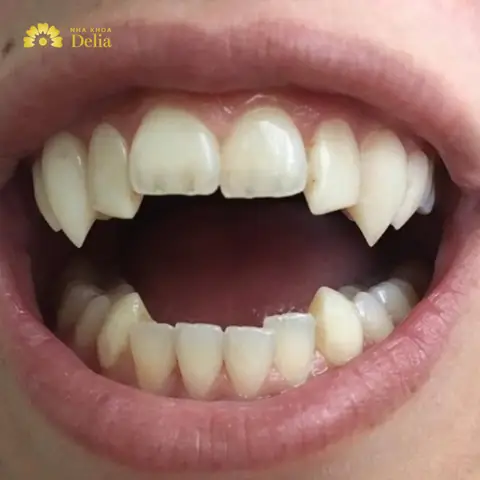 Tướng Răng Chó