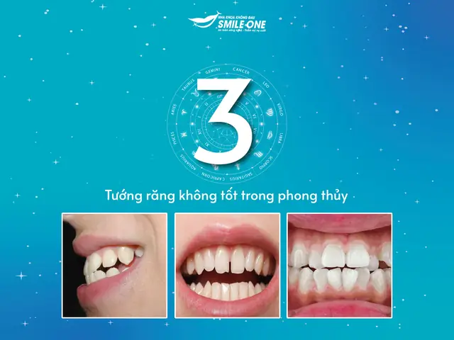 Tướng Răng Cửa Khấp Khểnh