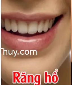 Tướng Răng Hổ