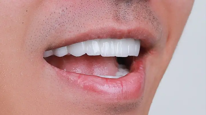 Tướng Răng Nói Lên Điều Gì