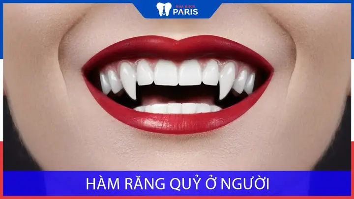 Tướng Răng Quỷ