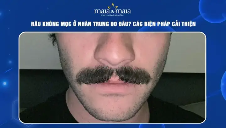 Tướng Râu Không Mọc Ở Nhân Trung Tướng Râu Không Mọc Ở Nhân Trung