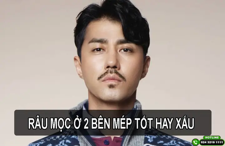 Tướng Râu Ria Mép
