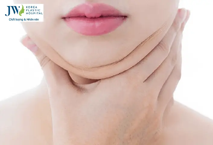 Tướng Số Người Có Nọng Cằm