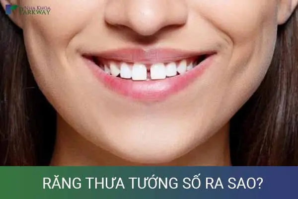 Tướng Số Người Răng Thưa Tướng Số Người Răng Thưa
