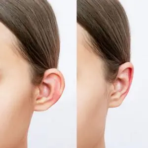 Tướng Tai Áp Sát Đầu Nữ