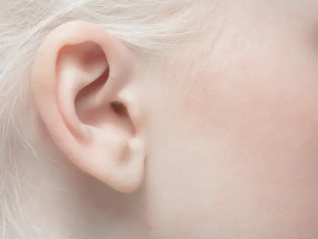 Tướng Tai Áp Sát Đầu Nữ