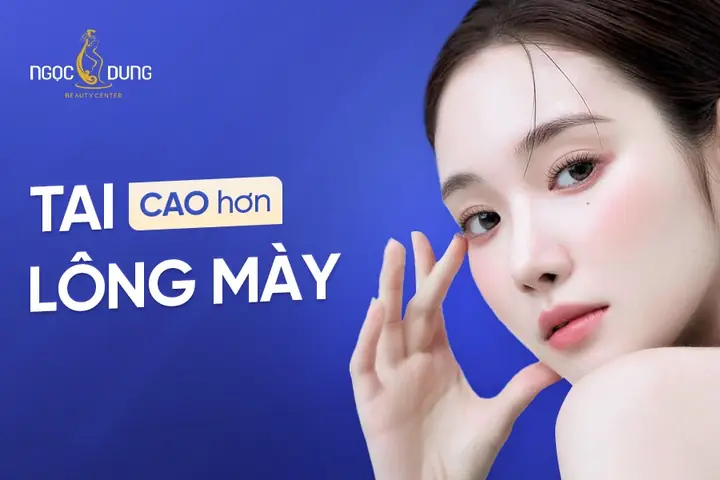 Tướng Tai Cao Ngang Lông Mày