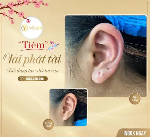 Tướng Tai Giàu Có