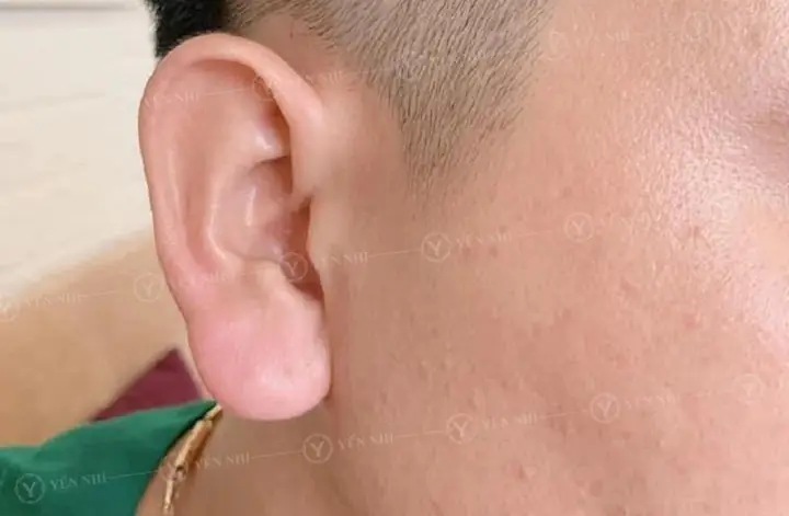 Tướng Tai Giàu Có