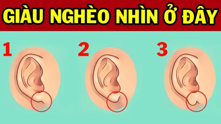Tướng Tai Giàu Có