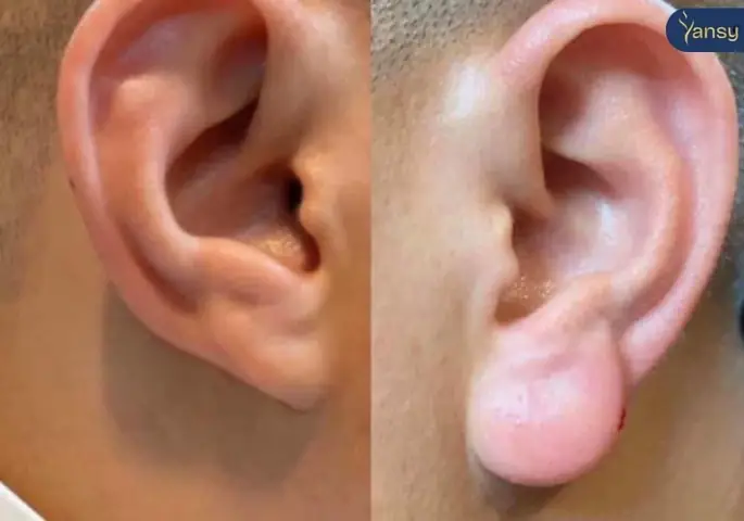 Tướng Tai Tài Lộc
