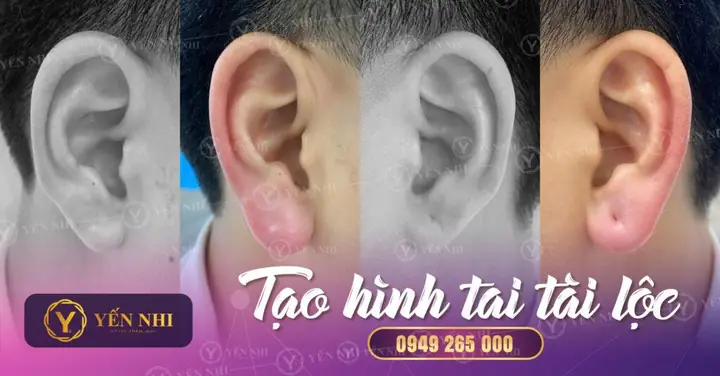 Tướng Tai Tài Lộc